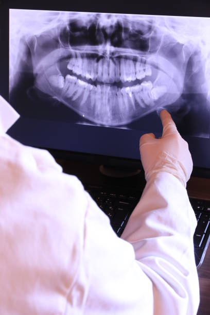 Best Dentist for Tooth Abscess  in High Springs, FL